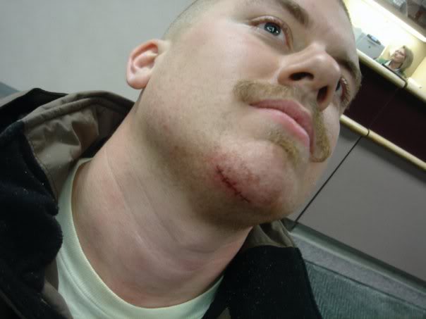 deadlift face fixed